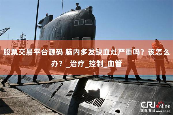 股票交易平台源码 脑内多发缺血灶严重吗？该怎么办？_治疗_控制_血管